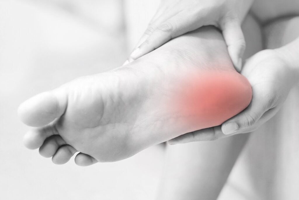 Black and white image of foot, with red glowing around the heel of the foot to signify pain.